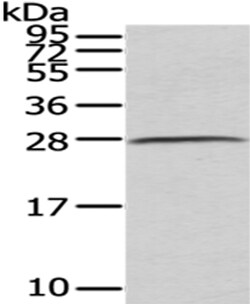 Invitrogen C1QB Polyclonal Antibody 100 &mu;L; Unconjugated:Antibodies,
