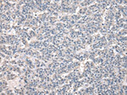 Invitrogen NPC2 Polyclonal Antibody 100 &mu;L | Buy Online | Invitrogen&trade; | Fisher Scientific