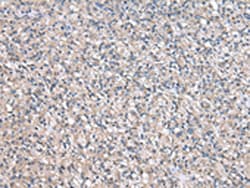 Invitrogen NPC2 Polyclonal Antibody 100 &mu;L | Buy Online | Invitrogen&trade; | Fisher Scientific