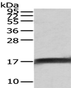 Invitrogen NPC2 Polyclonal Antibody 100 &mu;L | Buy Online | Invitrogen&trade; | Fisher Scientific