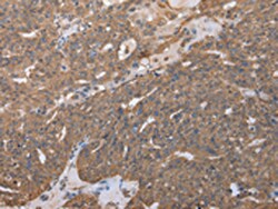 Invitrogen RARS Polyclonal Antibody 100 &mu;L; Unconjugated:Antibodies,