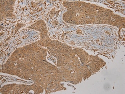 Invitrogen CYP20A1 Polyclonal Antibody 100 &mu;L; Unconjugated:Antibodies,