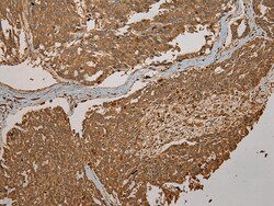 Invitrogen CYP20A1 Polyclonal Antibody 100 &mu;L; Unconjugated:Antibodies,