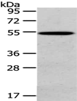 Invitrogen HGD Polyclonal Antibody 100 &mu;L; Unconjugated:Anticuerpos