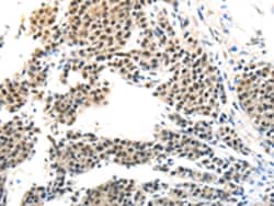Invitrogen MAGEA6 Polyclonal Antibody 100 &mu;L; Unconjugated:Antibodies,