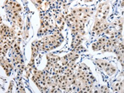Invitrogen MAGEA6 Polyclonal Antibody 100 &mu;L; Unconjugated:Antibodies,