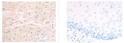 Invitrogen SLC8B1 Polyclonal Antibody 100 &mu;L; Unconjugated:Antibodies,