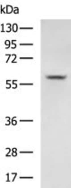 Invitrogen SLC8B1 Polyclonal Antibody 100 &mu;L; Unconjugated:Antibodies,