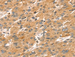 Invitrogen SPATA18 Polyclonal Antibody 100 &mu;L; Unconjugated:Antibodies,