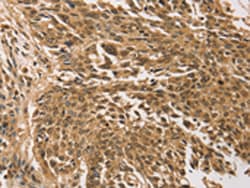 Invitrogen TGM7 Polyclonal Antibody 100 &mu;L; Unconjugated:Antibodies,