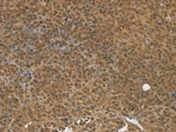 Invitrogen TGM7 Polyclonal Antibody 100 &mu;L; Unconjugated:Antibodies,