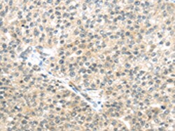 Invitrogen TTBK2 Polyclonal Antibody 100 &mu;L | Buy Online | Invitrogen&trade; | Fisher Scientific