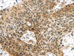Invitrogen TTBK2 Polyclonal Antibody 100 &mu;L | Buy Online | Invitrogen&trade; | Fisher Scientific
