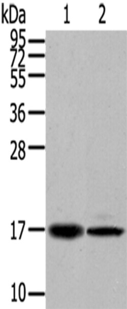 Invitrogen TUSC5 Polyclonal Antibody 100 &mu;L | Buy Online | Invitrogen&trade; | Fisher Scientific