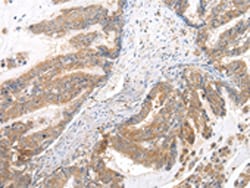 Invitrogen XKRX Polyclonal Antibody 100 &mu;L; Unconjugated:Antibodies,