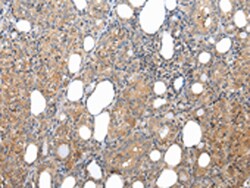 Invitrogen XKRX Polyclonal Antibody 100 &mu;L; Unconjugated:Antibodies,