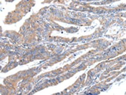 Invitrogen ZFAND2A Polyclonal Antibody 100 &mu;L; Unconjugated:Antibodies,