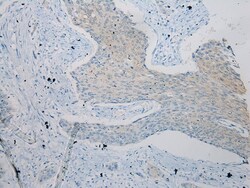 Invitrogen ZFP30 Polyclonal Antibody 100 &mu;L | Buy Online | Invitrogen&trade; | Fisher Scientific
