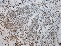 Invitrogen ZNF200 Polyclonal Antibody 100 &mu;L; Unconjugated:Antibodies,