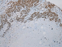Invitrogen ZNF200 Polyclonal Antibody 100 &mu;L; Unconjugated:Antibodies,