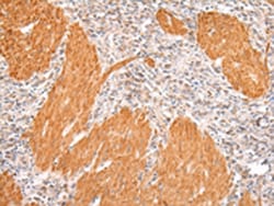 Invitrogen IKZF4 Polyclonal Antibody 100 &mu;L | Buy Online | Invitrogen&trade; | Fisher Scientific