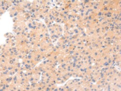 Invitrogen IKZF4 Polyclonal Antibody 100 &mu;L | Buy Online | Invitrogen&trade; | Fisher Scientific