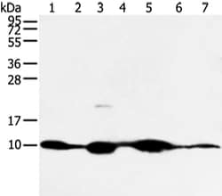 Invitrogen COX7C Polyclonal Antibody 100 &mu;L | Buy Online | Invitrogen&trade; | Fisher Scientific
