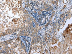 Invitrogen SPINK7 Polyclonal Antibody 100 &mu;L; Unconjugated:Anticuerpos