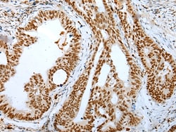 Invitrogen DEK Polyclonal Antibody 100 &mu;L; Unconjugated:Antibodies,