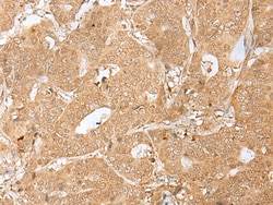 Invitrogen PEG3 Polyclonal Antibody 100 &mu;L; Unconjugated:Antibodies,