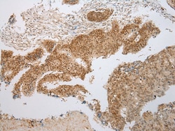 Invitrogen PPIL1 Polyclonal Antibody 100 &mu;L; Unconjugated:Antibodies,