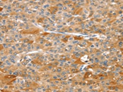Invitrogen RIPK5 Polyclonal Antibody 100 &mu;L; Unconjugated:Antibodies,