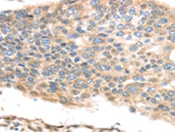 Invitrogen TMED2 Polyclonal Antibody 100 &mu;L; Unconjugated:Antibodies,