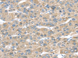 Invitrogen TMED2 Polyclonal Antibody 100 &mu;L; Unconjugated:Antibodies,