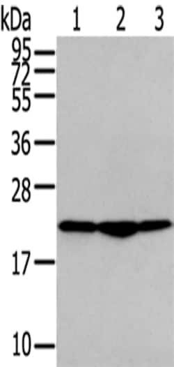 Invitrogen TMED2 Polyclonal Antibody 100 &mu;L | Buy Online | Invitrogen&trade; | Fisher Scientific