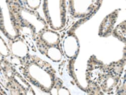 Invitrogen MED18 Polyclonal Antibody 100 &mu;L; Unconjugated:Antibodies,