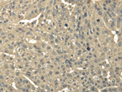TRIB2 Polyclonal Antibody:Antibodies, Polyclonal