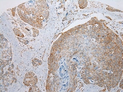 Invitrogen NDUFB6 Polyclonal Antibody 100 &mu;L; Unconjugated:Antibodies,