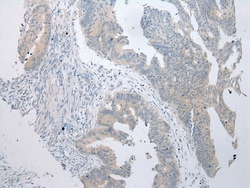 Invitrogen BBS9 Polyclonal Antibody 100 &mu;L; Unconjugated:Antibodies,