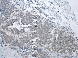 Invitrogen BBS9 Polyclonal Antibody 100 &mu;L; Unconjugated:Antibodies,