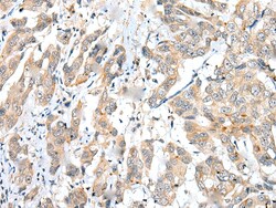 Invitrogen FUOM Polyclonal Antibody 100 &mu;L; Unconjugated:Antibodies,