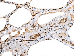 Invitrogen Cardiac Troponin C Polyclonal Antibody 100 &mu;L; Unconjugated:Antibodies,