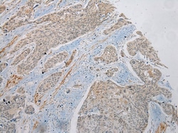 Invitrogen PLA2G12A Polyclonal Antibody 100 &mu;L; Unconjugated:Antibodies,