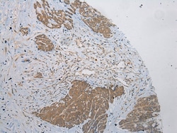 Invitrogen PLA2G12A Polyclonal Antibody 100 &mu;L; Unconjugated:Antibodies,