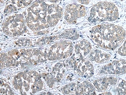 Invitrogen COMMD10 Polyclonal Antibody 100 &mu;L; Unconjugated:Antibodies,