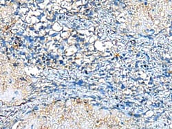 Invitrogen COMMD10 Polyclonal Antibody 100 &mu;L; Unconjugated:Antibodies,