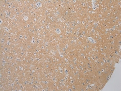 Invitrogen FOXN2 Polyclonal Antibody 100 &mu;L; Unconjugated:Antibodies,