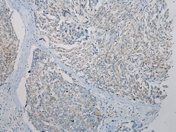 Invitrogen FOXN2 Polyclonal Antibody 100 &mu;L; Unconjugated:Antibodies,