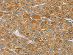 Invitrogen TP53I11 Polyclonal Antibody 100 μL; Unconjugated:Antibodies,