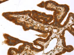 Invitrogen TP53I11 Polyclonal Antibody 100 μL; Unconjugated:Antibodies,